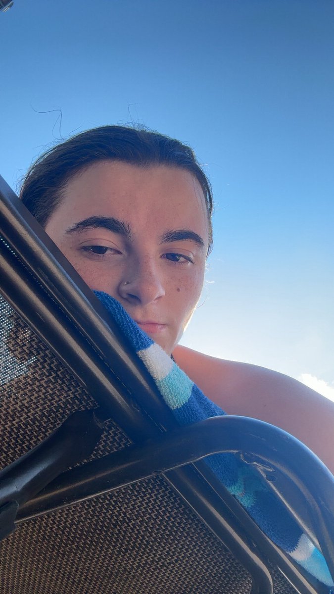 My freckles after being at the pool and in the sun for an hour