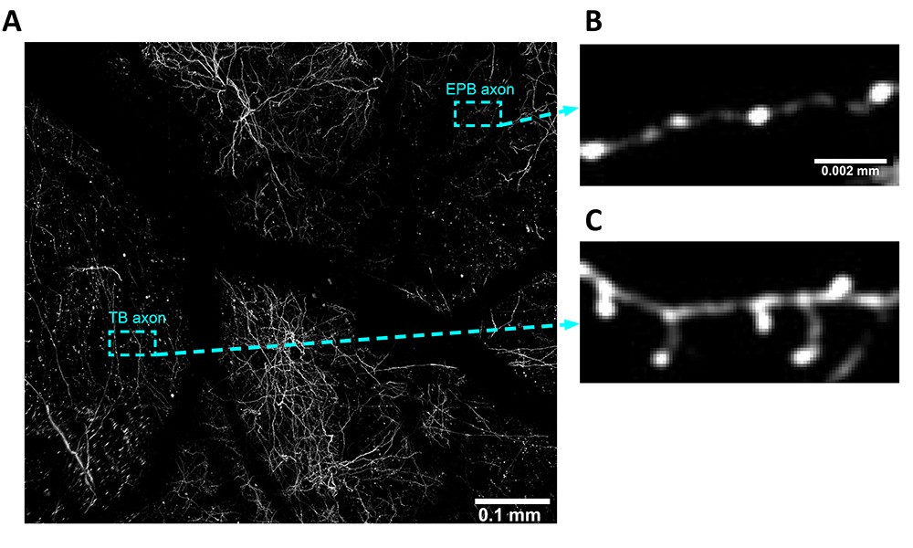 Low-intensity brain stimulation may restore neuron health in #Alzheimers disease spie.org/news/low-inten…

#dementia #neuroscience #science