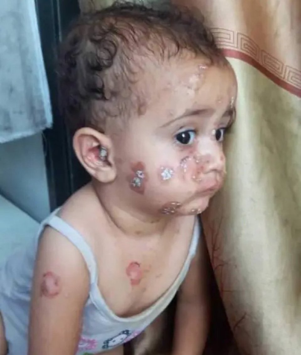 If u see this pretty angel, reply with 💔🇵🇸 Pray for her.💔