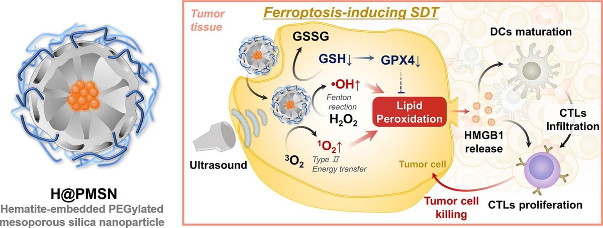 Hematite-embedded mesoporous nanoparticles for ferroptosis-inducing cancer sonoimmunotherapy.
| Jae Hyung Park <a href="/SKKU_1398/">SKKU</a> | <a href="/KoreaCRS/">CRS Korea Chapter</a> 
[50 days' free access]
#MesoporousNanoparticle #hematite #sonoimmunotherapy 
 kwnsfk27.r.eu-west-1.awstrack.me/L0/https:%2F%2…