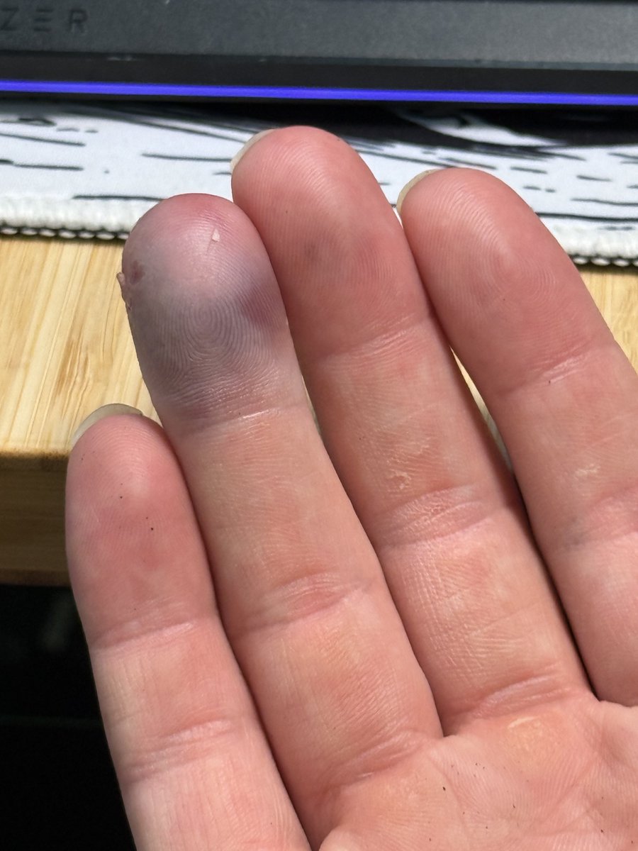 EsfandTV tweet media