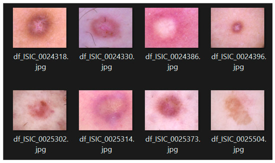 Applied Sciences MDPI (@applsci) on Twitter photo π₯ Read our Paper
π Moving Healthcare AI Support Systems for Visually Detectable Diseases to Constrained Devices
π mdpi.com/2076-3417/14/2β¦
π¨βπ¬ byΒ Tess Watt,Christos Chrysoulas,Peter J. Barclay,Brahim El BoudaniΒ andGrigorios Kalliatakis.
<a href="/HeriotWattUni/">Heriot-Watt University</a>
#tinyML #computing π₯ Read our Paper
π Moving Healthcare AI Support Systems for Visually Detectable Diseases to Constrained Devices
π mdpi.com/2076-3417/14/2β¦
π¨βπ¬ byΒ Tess Watt,Christos Chrysoulas,Peter J. Barclay,Brahim El BoudaniΒ andGrigorios Kalliatakis.
<a href="/HeriotWattUni/">Heriot-Watt University</a>
#tinyML #computing