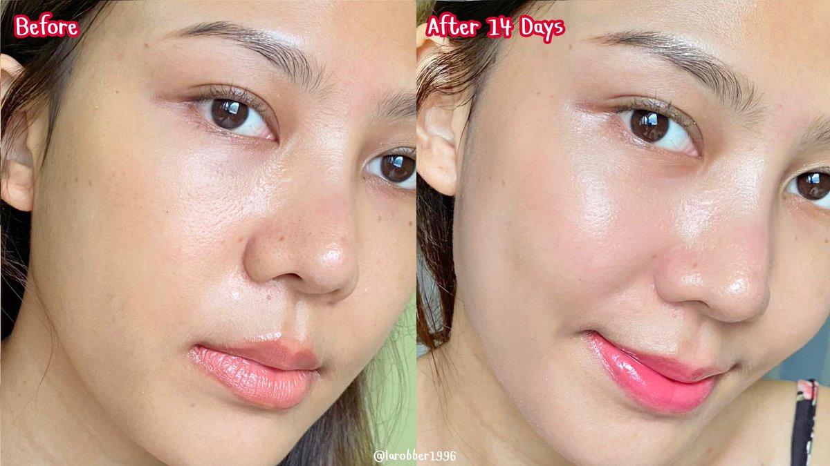 แบรนด์ไทยปังๆต้องมอบมงให้ KA นะ เริ่ดทุกตัวว ล่าสุดผิวฟูกระชับเพราะสองตัวนี้เลย เนื้อดีมากกกก ซึมไวไม่หนักผิว ใช้แล้วผิวเฟิร์มขึ้น ริ้วรอยเล็กๆมันดูตื้นอะ ผิวดูใสไม่โทรมดี ชอบบบ
#เคเอเอจจิ้งโปร #KAAgingPro #มือโปรเรื่องริ้วรอย #ลดริ้วรอย #ของดีบอกต่อ #รีวิวสกินแคร์