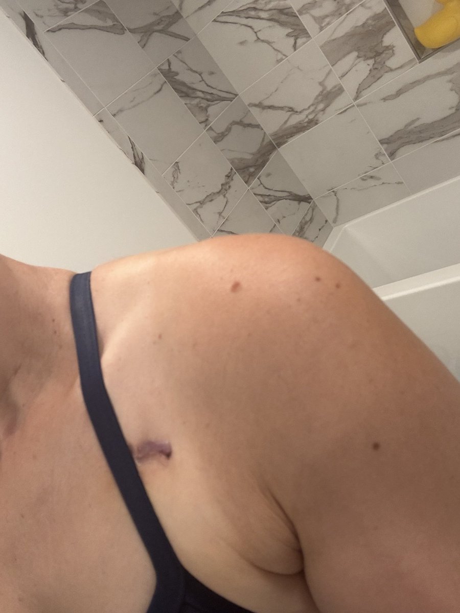 Okay! I swam a mile for the first time since my port got taken out! My arm worked!! And yes that is a gigantic rubber ducky in my bathtub.