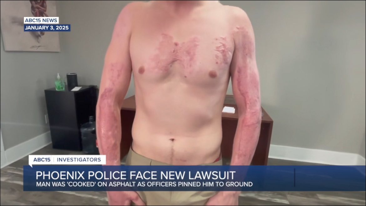 DaveBiscobing15's tweet image. Man &apos;cooked&apos; on pavement files lawsuit against Phoenix Police Department

 abc15.com/news/local-new…