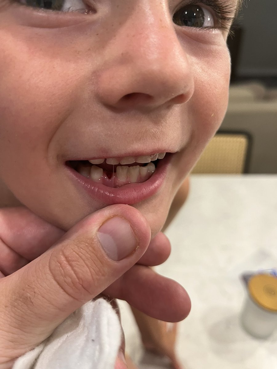 Parents of young kids, let’s all get on the same page…
You’re not really giving $5 for this tooth right? Tell me, my guy is spinning a yarn right?