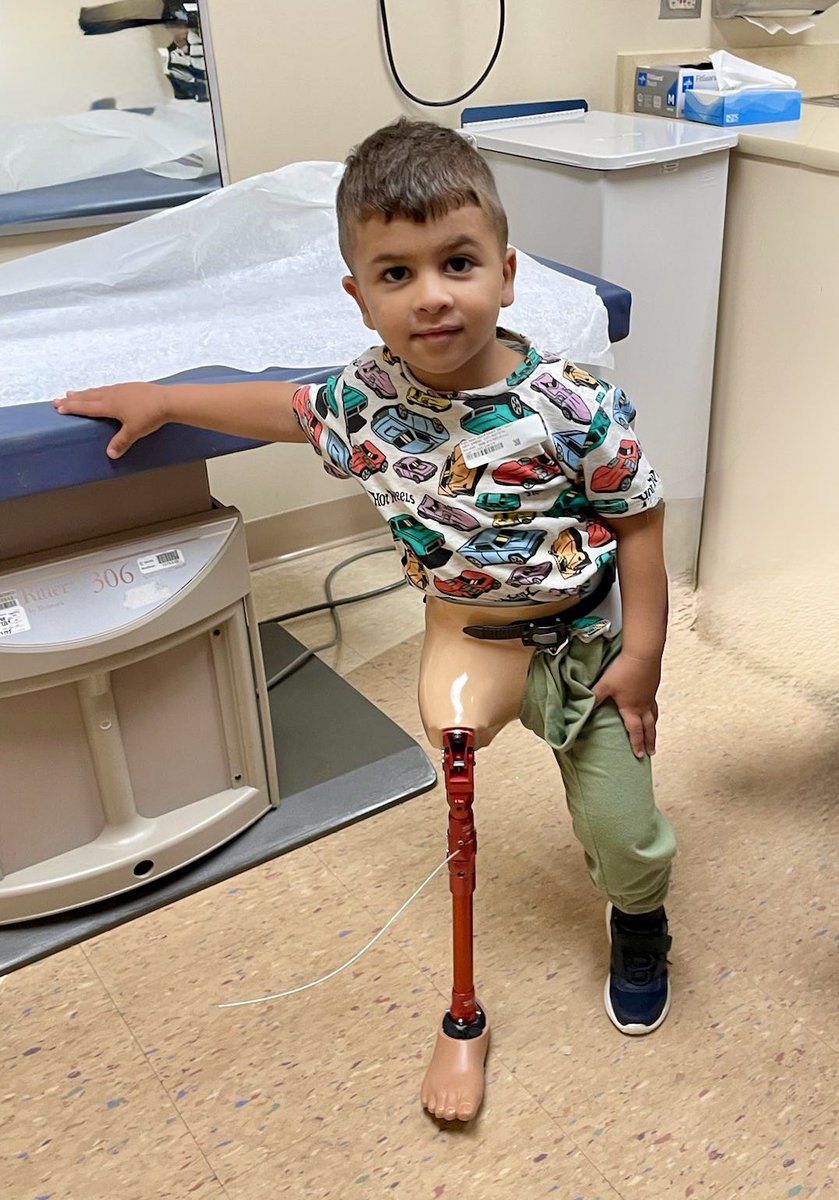 Stevesosebee's tweet image. Four-year-old Adam from Gaza, whose entire family was killed by an IOF bomb and who was brought to the US by @healpalestine_ a few months ago received his prosthetic leg this week and is learning to walk again. While warmongers meet in DC to plan more atrocities there are…