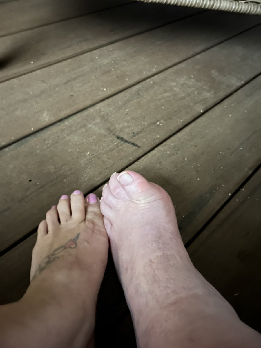 chucklettes's tweet photo. Foot fettish https://t.co/h4Y887EXub