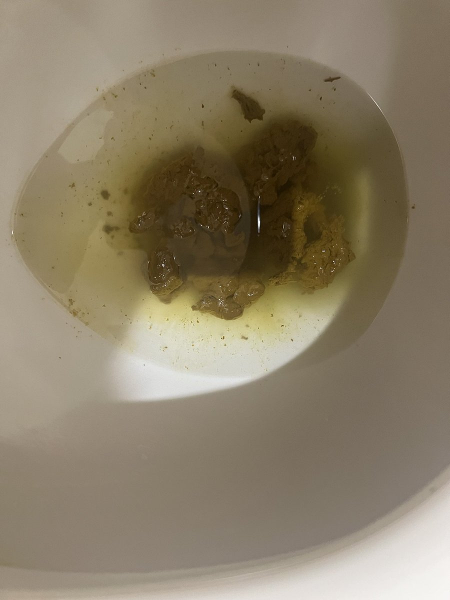 これ一気に全部でたからびっくりした🙈