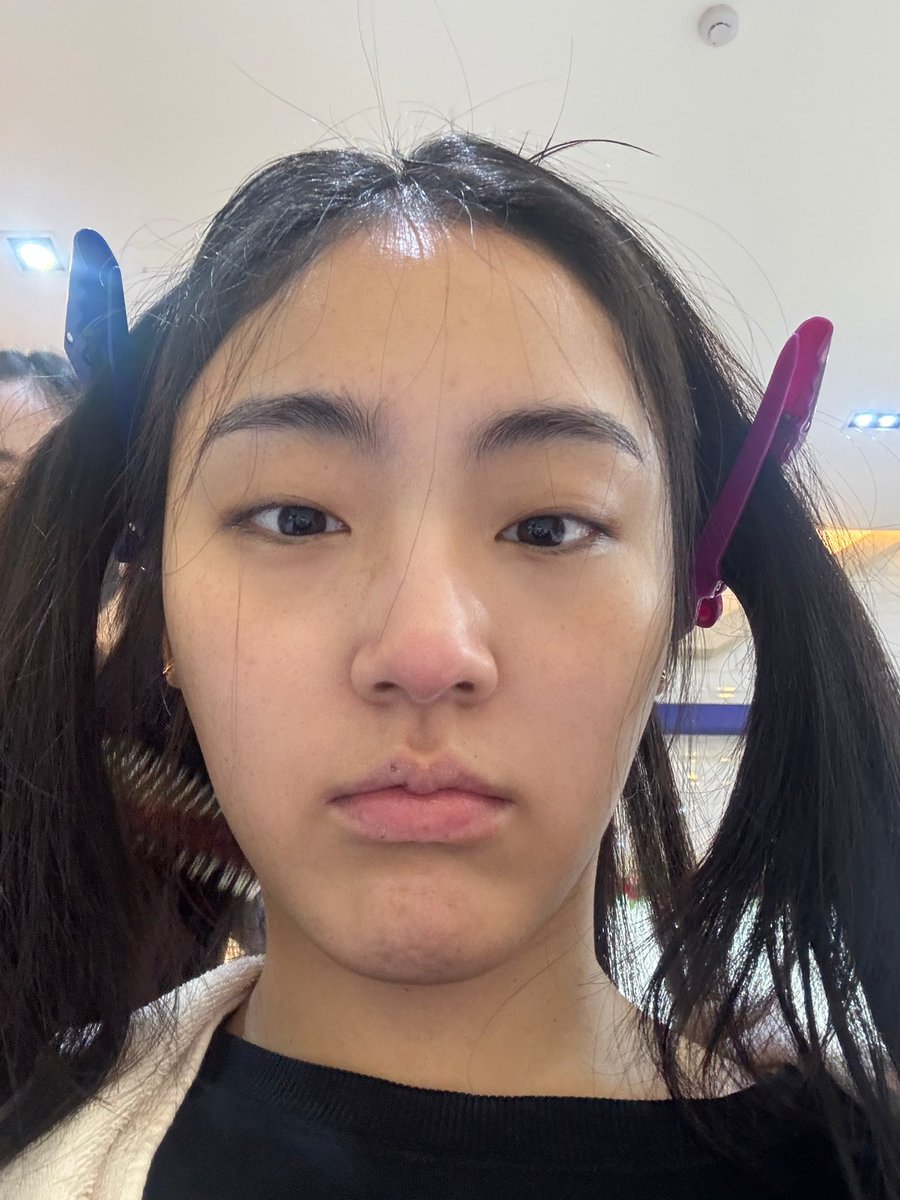 ทุกคน ยุงกัดจมูกหนู หนูเหมือนกวางเรนเดียวันคริสมาสเลย