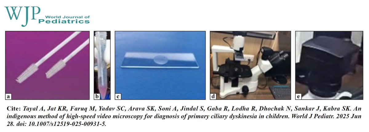 World_J_Pediatr's tweet image. An indigenous high-speed video microscopy method offers a low-cost, accessible diagnostic tool for primary ciliary dyskinesia in children.
#Meded #SoMe4PedSurg #Pediatrics #PrimaryCiliaryDyskinesia #Diagnostics #RespiratoryHealth
link.springer.com/article/10.100…