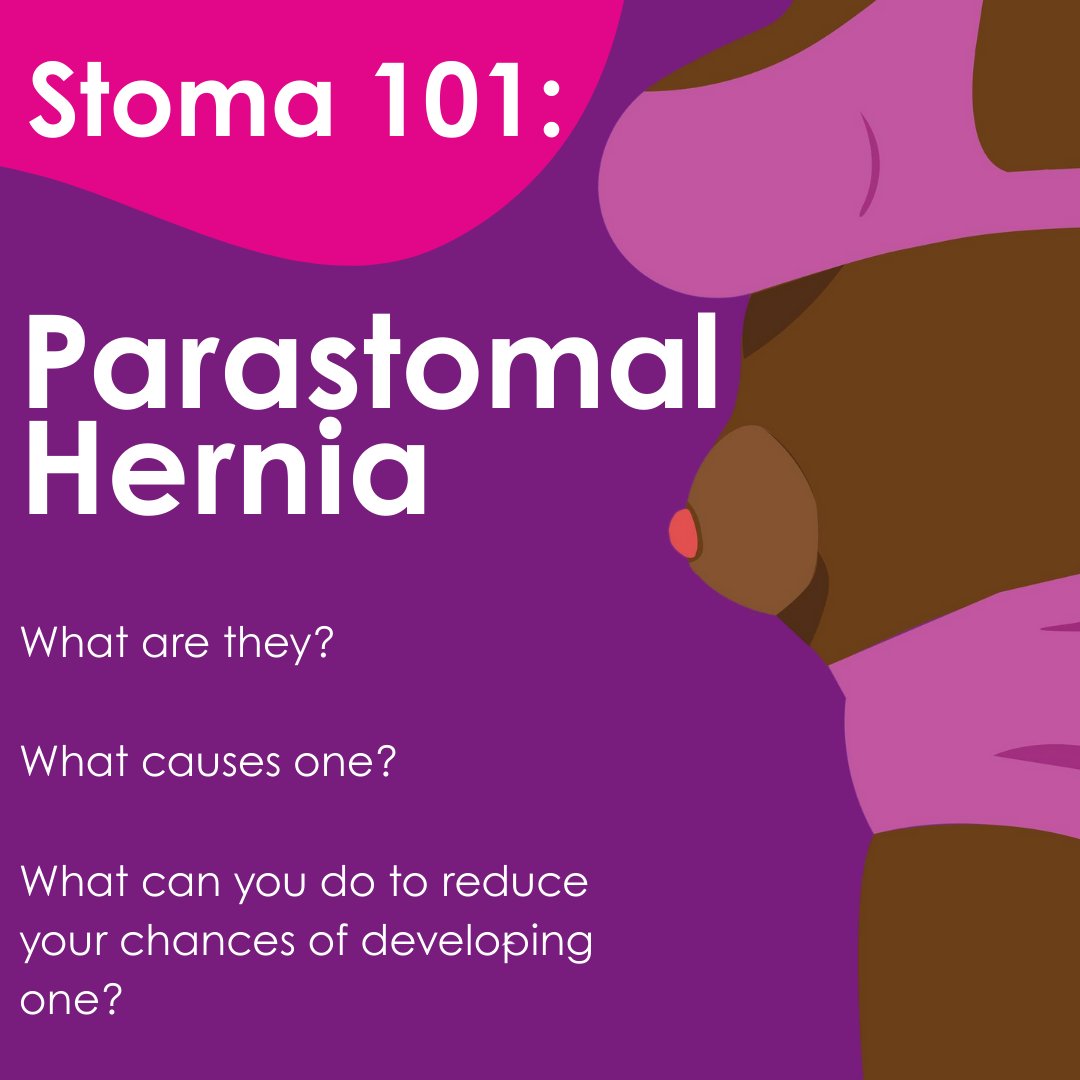 Research shows that between 50 to 70 percent of #ostomates will develop a Parastomal Hernia. What are they? What causes one? What can you do to reduce your chances of developing one?

Our website has answers to the questions above ow.ly/l2qJ50OgPGr

 #stoma