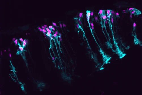 newswise (@newswise) on Twitter photo #AI Reveals Astrocytes Play a āStarringā Role in Dynamic #Brain Function
A new <a href="/FloridaAtlantic/">Florida Atlantic University</a> study reveals a neglected brain cell plays a bigger role than expectedāreshaping how we understand the brain.
newswise.com/articles/ai-re⦠#AI Reveals Astrocytes Play a āStarringā Role in Dynamic #Brain Function
A new <a href="/FloridaAtlantic/">Florida Atlantic University</a> study reveals a neglected brain cell plays a bigger role than expectedāreshaping how we understand the brain.
newswise.com/articles/ai-reā¦