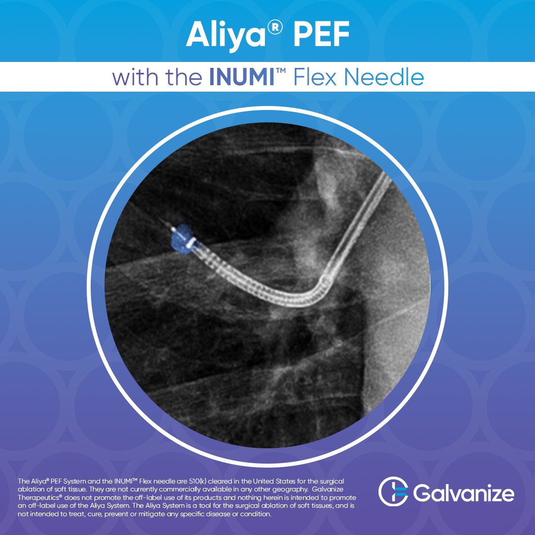 Aliya® PEF with INUMI™ Flex: Enabling physicians to deliver Pulsed Electric Field (#PEF) energy to soft tissue lesions in any location accessible by an endoscope.

Learn more by visiting GalvanizeTX.com!

#INUMIFlex #PulsedElectricFields #MIS #iPeeps
