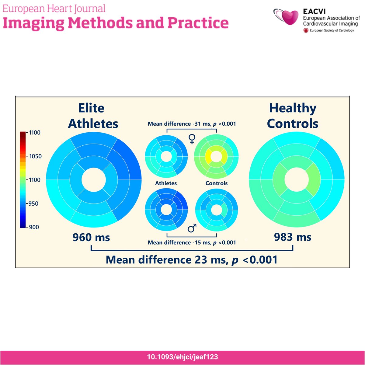 EHJCVIEiC's tweet image. #EHJCVI 🧠 Do T1 map values vary between healthy athletes and non-athletic controls? 📉 What healthy reference values should we consider for this population? 🏃♂️📊 Check this cross-sectional study showing decreased native T1 values in elite athletes 👉 doi.org/10.1093/ehjci/…