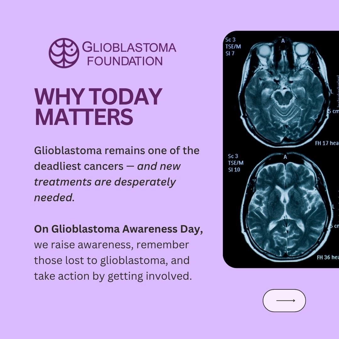 glioblastf's tweet image. Join us in recognizing Glioblastoma Awareness Day today— a day to amplify the urgent need for better treatments, more research, and stronger support for the glioblastoma community.
This isn’t just a day on the calendar.
It’s a call to action.
Raise awareness by sharing this…
