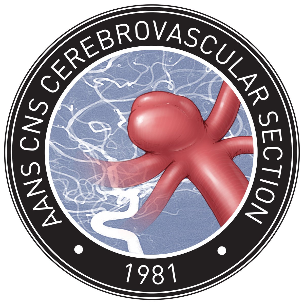 NREFORG's tweet image. Congrats to the 2025 recipients of the AANS/CNS Cerebrovascular Section Traveling Fellowship! @JAGrossbergMD @ClemensSchirmer Thanks to @medtronic and @microvention for their support! @SemmesMurphey