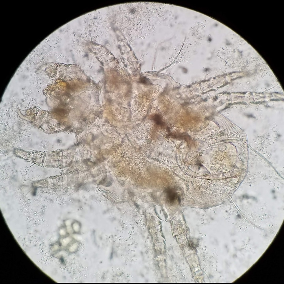 Vet_Parasites's tweet photo. Cheyletiella skin mite from a canine fecal float. Cheyletiellosis is also known as walking dandruff. The spread of Cheyletiella can be common in shelters where dogs have close contact with numerous other dogs. Humans can be incidentally infected #parasitology #parasites ##vettech https://t.co/yfTbzKGL8Y