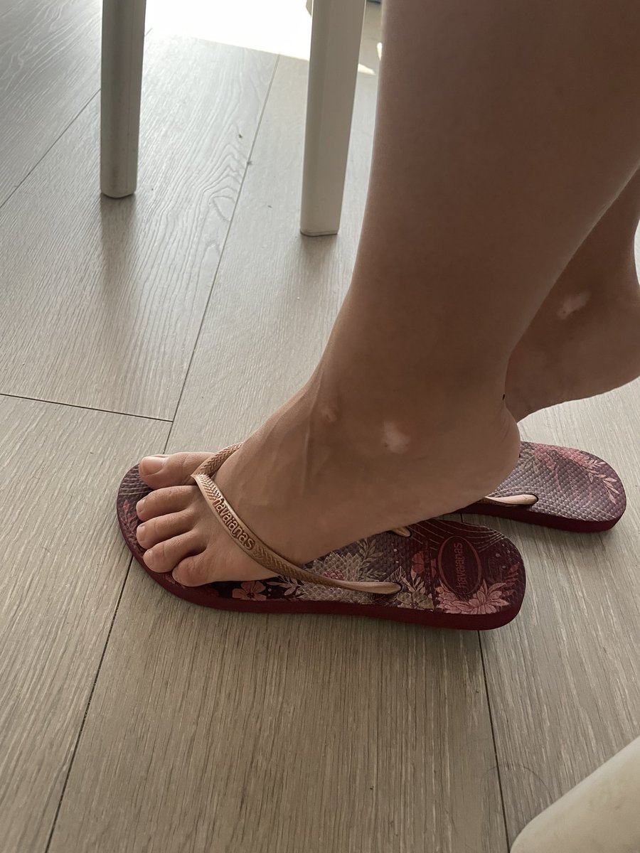 feetiligo's tweet photo. I don’t like much this pictures, are they good? https://t.co/9A1inUD3MW