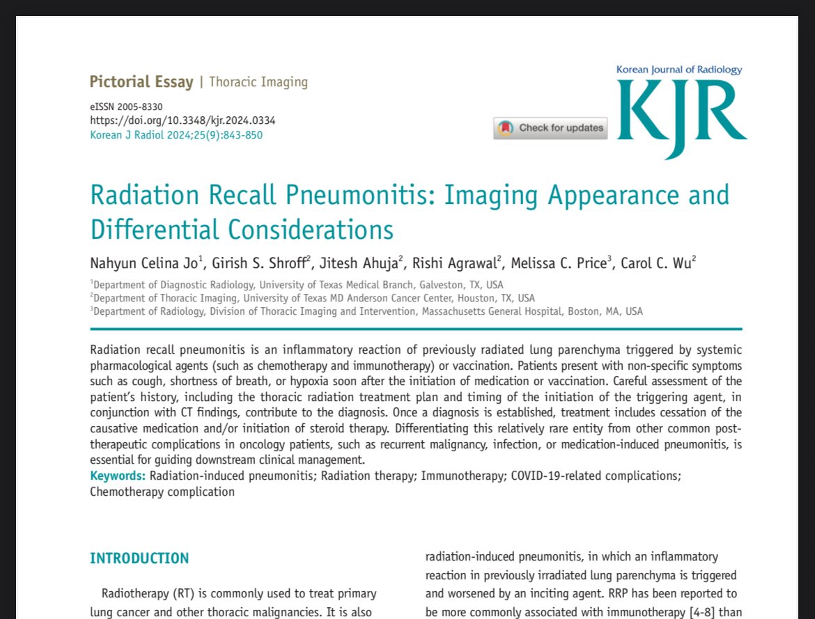 Daniel Vargas, MD (@danielvargasmd) on Twitter photo Really nice pictorial essay of an important entity to keep in mind! 👏 <a href="/carolcwu1/">Carol Wu</a> 👏
<a href="/thoracicrad/">Society of Thoracic Radiology</a> <a href="/atscommunity/">American Thoracic Society (ATS)</a> <a href="/CasesCookyJar/">Cases From the Cooky Jar</a> <a href="/marcosmestas/">Marcos Mestas Nuñez</a> <a href="/jonherochung/">Jonathan Chung, MD</a> <a href="/JoannaEscalonMD/">Joanna Escalon, MD</a> <a href="/LaurenGroner/">Lauren Kriger Groner</a> <a href="/Marcelo97843311/">Marcelo Sanchez</a> <a href="/hochhegger/">Bruno Hochhegger</a> Really nice pictorial essay of an important entity to keep in mind! 👏 <a href="/carolcwu1/">Carol Wu</a> 👏
<a href="/thoracicrad/">Society of Thoracic Radiology</a> <a href="/atscommunity/">American Thoracic Society (ATS)</a> <a href="/CasesCookyJar/">Cases From the Cooky Jar</a> <a href="/marcosmestas/">Marcos Mestas Nuñez</a> <a href="/jonherochung/">Jonathan Chung, MD</a> <a href="/JoannaEscalonMD/">Joanna Escalon, MD</a> <a href="/LaurenGroner/">Lauren Kriger Groner</a> <a href="/Marcelo97843311/">Marcelo Sanchez</a> <a href="/hochhegger/">Bruno Hochhegger</a>