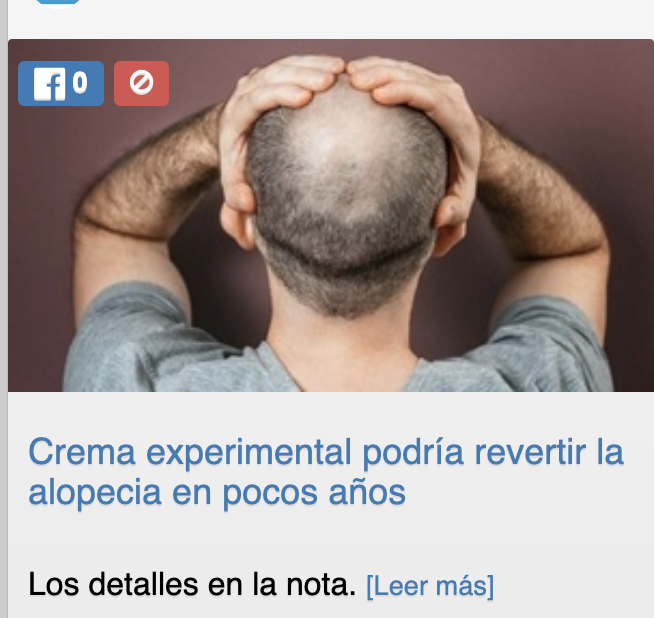 Estas si que son noticias,
no las pavadas que leo
en este mundo tan feo,
pleno de tanta injusticia.

La ciencia está de nuestro lado.
A los que quedamos sin cabello
nos pintan un futuro bello.
¡Vamo arriba los peladooo!