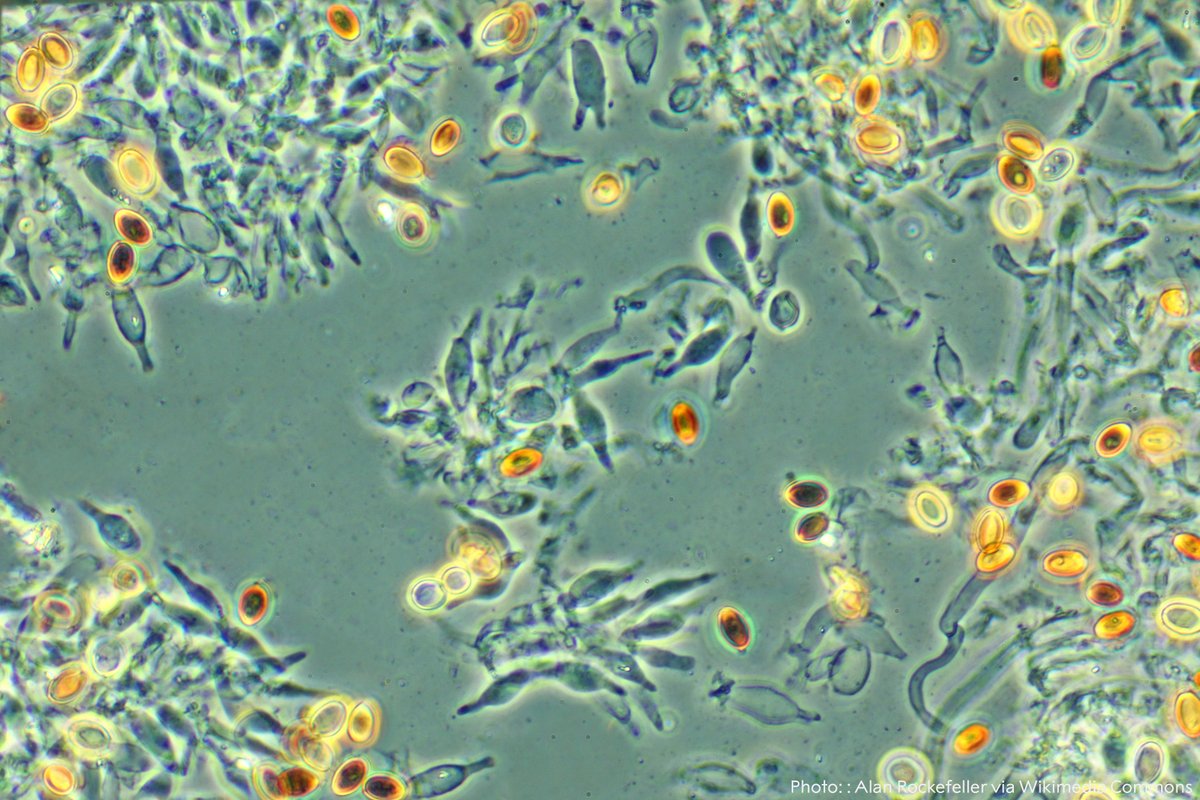 Have you ever used a phase-contrast microscope? 

Invented by 1953 physics laureate Frits Zernike, phase contrast microscopy transforms phase variations of light, which can then be observed by the human eye. This advanced the study of living cells.