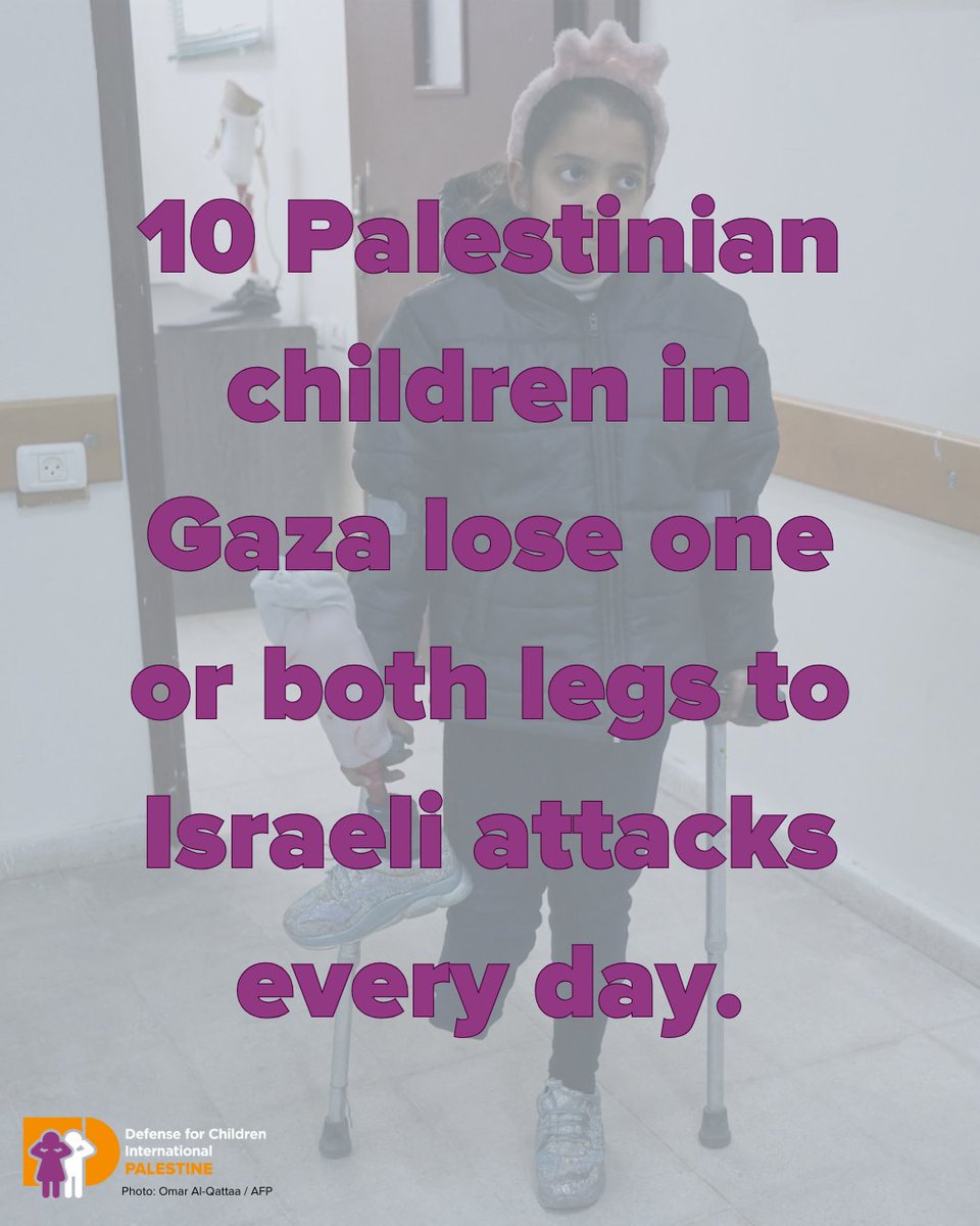 DCIPalestine's tweet image. Every day, 10 Palestinian children lose one or both legs to ongoing Israeli attacks in Gaza. These injuries will physically and psychologically affect children for the rest of their lives.
Read more: ow.ly/MMGW50WqFgh