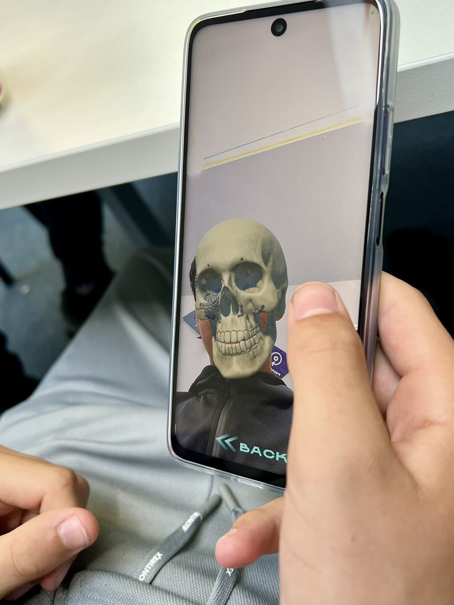 Prof Christine Goodall (@drgoodalltweets) on Twitter photo It’s been a real pleasure to work with Ashna Konjeti on her MSc in Medical Visualisation project with <a href="/Innovation_Sch/">GSA School of Innovation and Technology</a> <a href="/UofGlasgow/">University of Glasgow</a>
She’s designed an app for young people to show the consequences of facial trauma.
We look forward to using it in the <a href="/MAVscotland/">Medics Against Violence</a> school programme It’s been a real pleasure to work with Ashna Konjeti on her MSc in Medical Visualisation project with <a href="/Innovation_Sch/">GSA School of Innovation and Technology</a> <a href="/UofGlasgow/">University of Glasgow</a>
She’s designed an app for young people to show the consequences of facial trauma.
We look forward to using it in the <a href="/MAVscotland/">Medics Against Violence</a> school programme