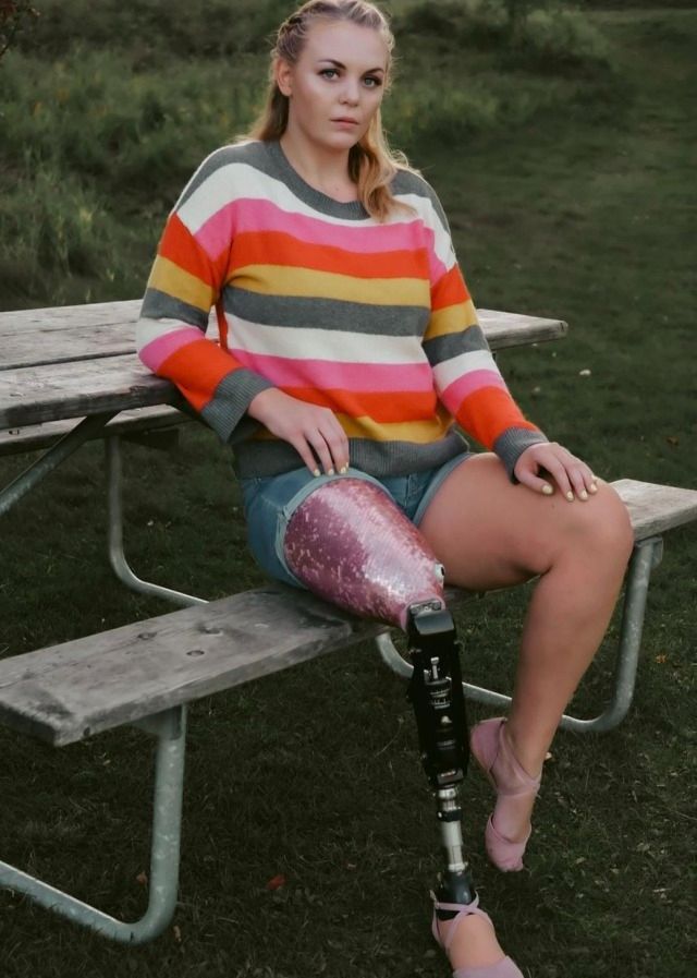 Kristinartz's tweet image. Life took a leg but not my strength. If you’ve read this far just say Hi or hit follow. Your small gesture might be the only gift I get today. 💔🙏