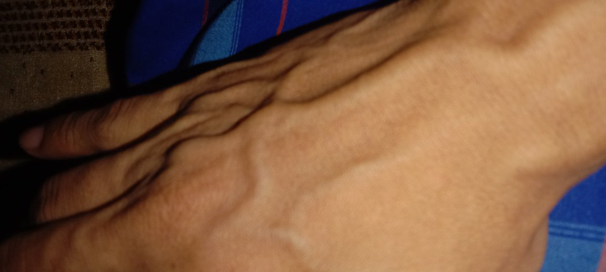 Tangan aja berurat apalagi si ANU