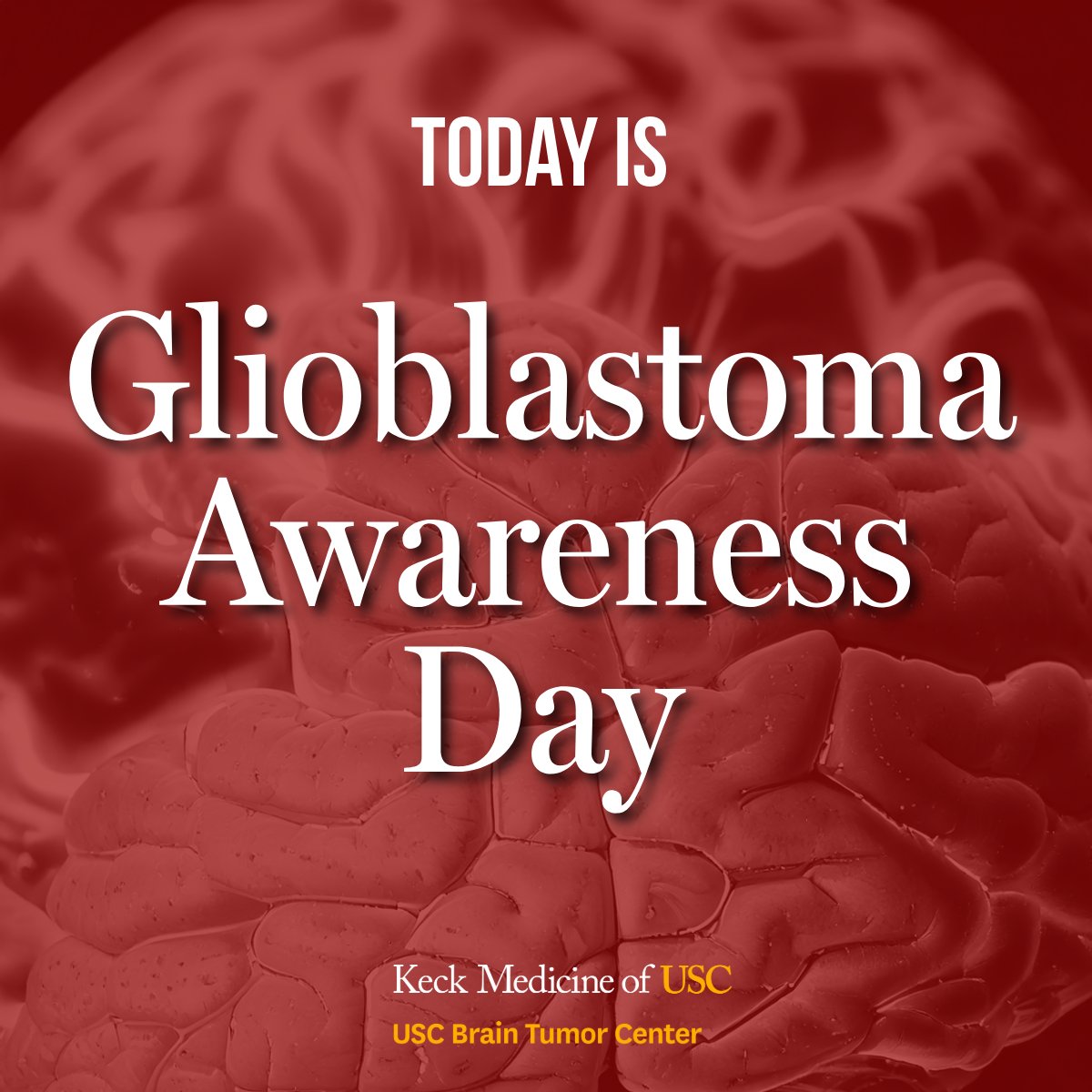 USCBTC's tweet image. 🎗️ Today is Glioblastoma Awareness Day.
Glioblastoma is the most aggressive form of brain cancer—complex, fast-moving, and incredibly difficult to treat. But behind every diagnosis is a person. A family. A fight.
At the USC Brain Tumor Center, we're committed to advancing…
