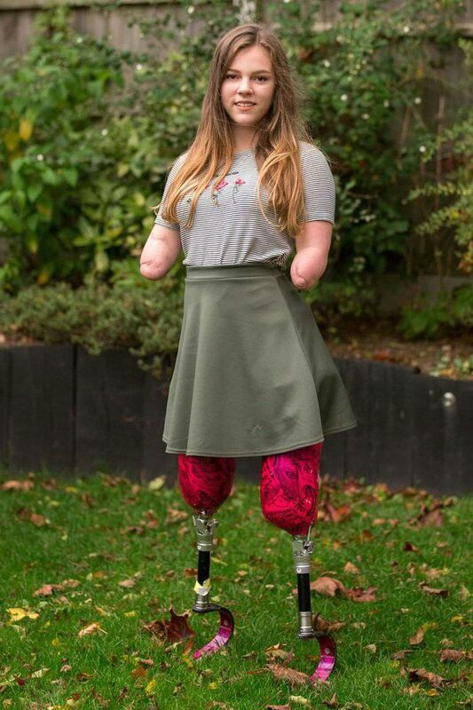Kristinartz's tweet image. No hands, no legs still I survive.
Sometimes, just a “Hi” or a Follow
is all it takes to ease the pain. 💔🙏
