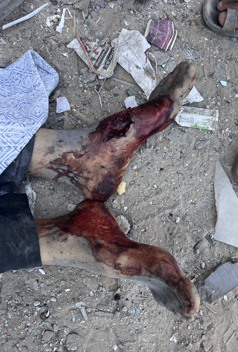 Four people have been KILLED in Israeli bombing of Al Sheikh Ridwan neighbourhood of Gaza City!

Two people have been KILLED and three others INJURED in Israeli bombing of Al Nuseirat refugee camp!

Three people have been KILLED in Israeli bombing of Khan Younis!