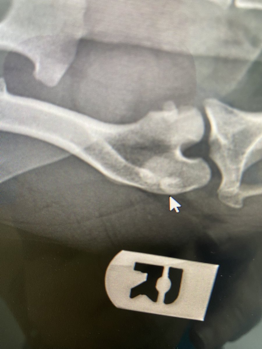 KGF2525's tweet photo. @RockyKanaka First time contacting you but watch your show.Have a 4 year old Teddy Bear took to vet and her rear left leg has a kneecap that dislocates. Left picture where arrow is good kneecap. Right picture arrow is problem kneecap.Need advice surgery or other  ways to fix it. https://t.co/do1F2nHeQt