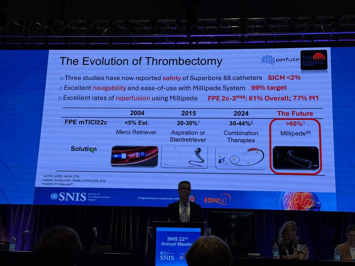 Daniel Vela-Duarte, MD (@danielvelamd) on Twitter photo MARRS
Millipede Aspiration for Revascularization in Stroke
Primary endpoint: mTICI ≥ 2b (Up to the 3 passes - Aspiration alone): 91%
First Pass Effect (FPE): 61% overall and 77% for M1 segment (088 system)
<a href="/SNISinfo/">SNIS Info</a> <a href="/RaulNogueiraMD/">Raul G Nogueira, MD, FAHA, FSVIN</a> <a href="/DanniDiestro/">Dr. DiestroKE</a>
#SNIS2025 MARRS
Millipede Aspiration for Revascularization in Stroke
Primary endpoint: mTICI ≥ 2b (Up to the 3 passes - Aspiration alone): 91%
First Pass Effect (FPE): 61% overall and 77% for M1 segment (088 system)
<a href="/SNISinfo/">SNIS Info</a> <a href="/RaulNogueiraMD/">Raul G Nogueira, MD, FAHA, FSVIN</a> <a href="/DanniDiestro/">Dr. DiestroKE</a>
#SNIS2025