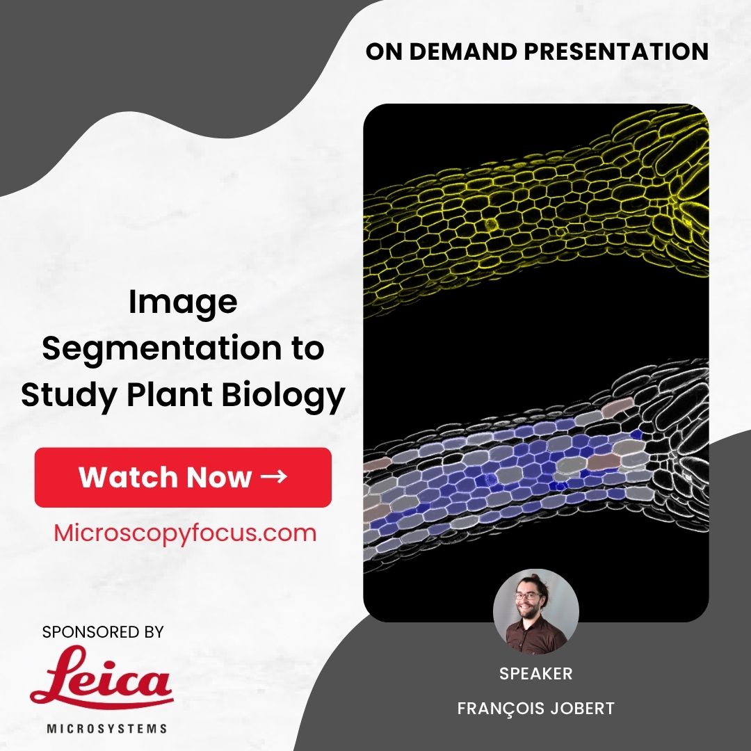BitesizeBio's tweet image. Missed the live webinar with @LeicaMicro? Watch on demand to learn how Cellpose and deep learning unlock automated plant image analysis and high-throughput phenotyping. Featuring Arabidopsis and Marchantia case studies. Watch Now → buff.ly/AurleRB #PlantScience #AI