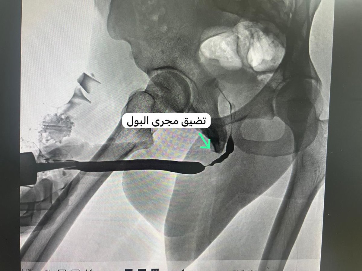 Dr.Meshal Albabtain د.مشعل البابطين tweet media
