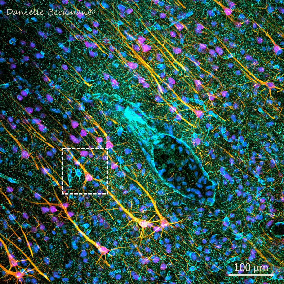 DaniBeckman's tweet image. Check out this cool astrocyte multitasking in the brain! It manages a blood vessel on one side while supporting a neuron on the other. Everything in the brain, from blood vessels to neurons, is interconnected! 🔬 🧠
#microscopy #Neuroscience