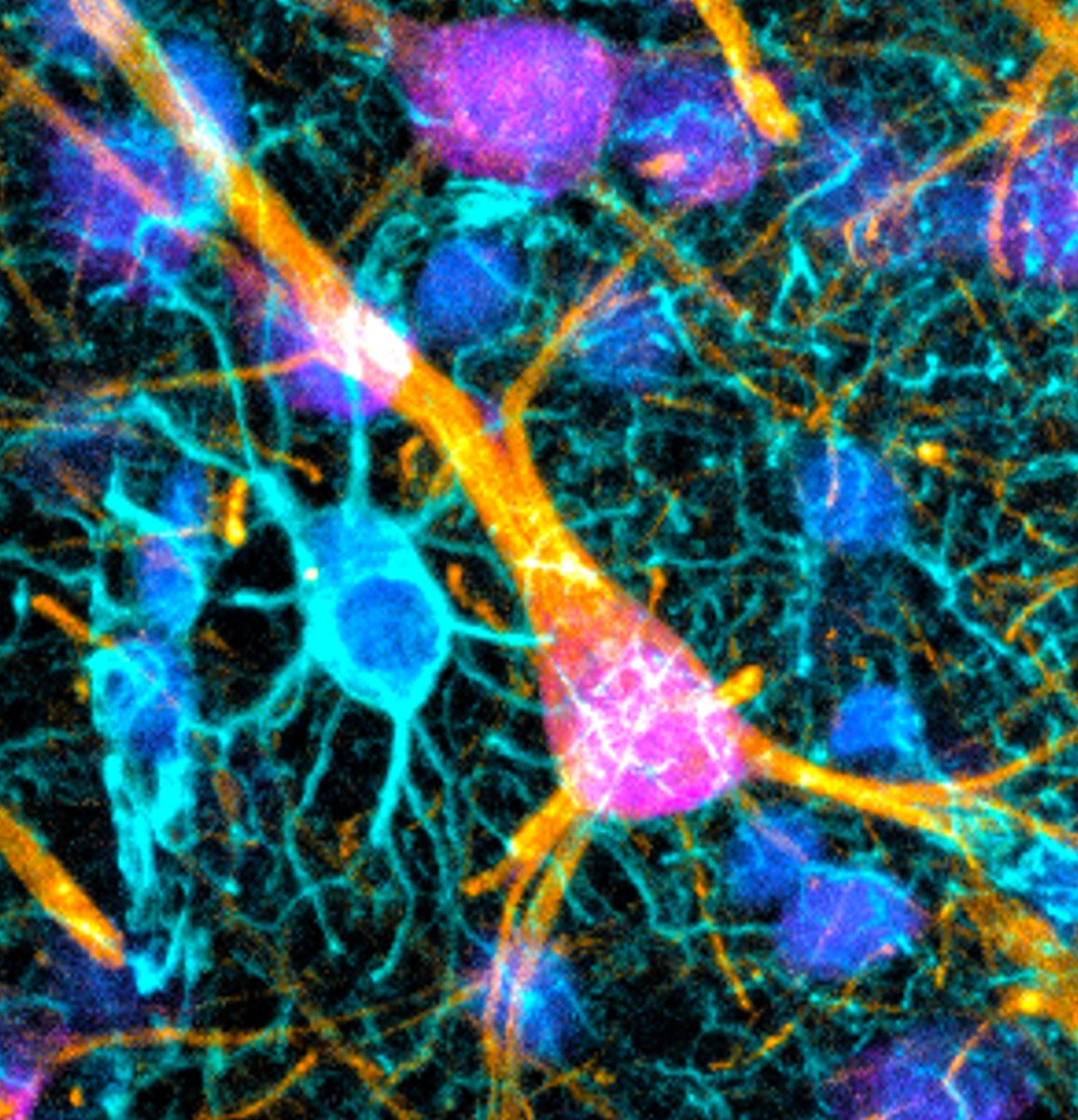 DaniBeckman's tweet image. Check out this cool astrocyte multitasking in the brain! It manages a blood vessel on one side while supporting a neuron on the other. Everything in the brain, from blood vessels to neurons, is interconnected! 🔬 🧠
#microscopy #Neuroscience