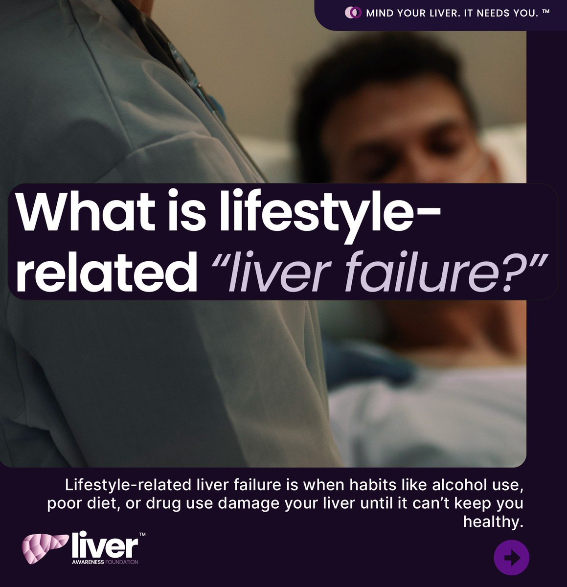 LiverAwareness's tweet image. What lifestyle factors can lead to liver failure?
Heavy or long-term alcohol use, fatty liver disease from poor diet or inactivity, and certain drug or medication toxicity are major causes. Early prevention matters.
#MindYourLiver #LiverHealth #LiverAwareness #Prevention