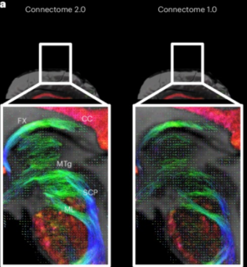 NIH's tweet image. News: Scientists Develop High-Performance MRI Scanner in Effort to Define Microscopic Brain Structures bit.ly/3IrtW7j