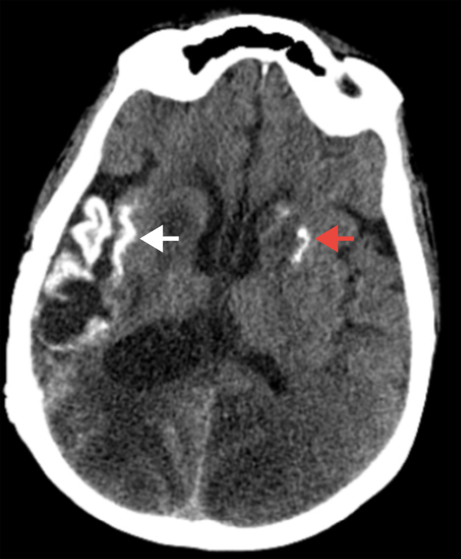 Journal of Neurology Research tweet media