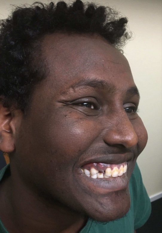🇸🇪🇪🇷 | El eritreo Ahmed Ibrahim Ahmed, de 27 años, podrá permanecer en Suecia a pesar de haber cometido 196 delitos y sido condenado al menos seis veces por agresiones, abusos sexuales, ataques a la policía con una piedra, amenazas con cuchillo y arrojar orina y heces a