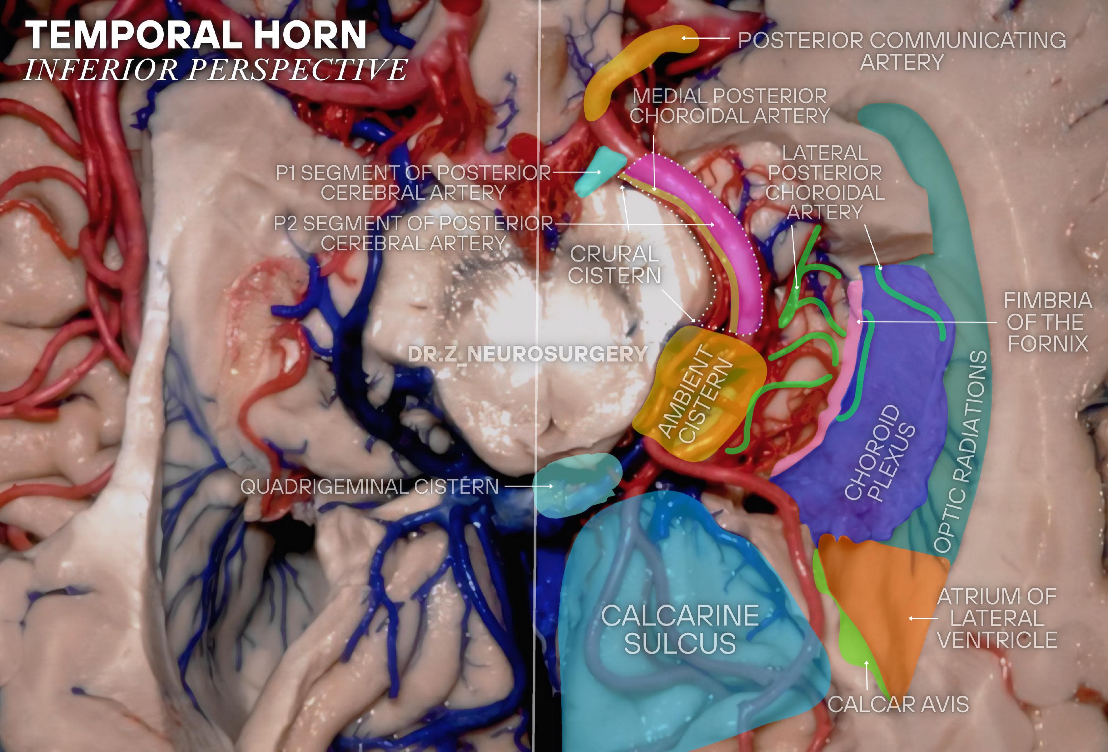 健康・医学 Micro-neurosurgical Atlas The Neurosurgical Atlas - Anatomy is the foundation of