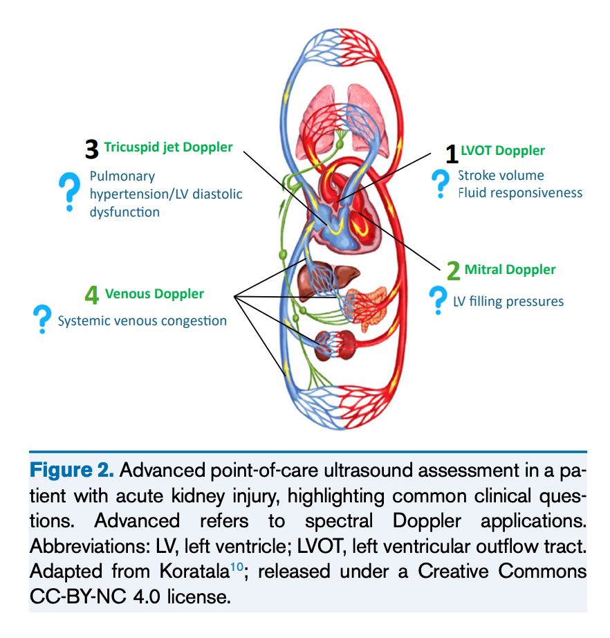 AJKD (@ajkdonline) on Twitter photo Perspective by <a href="/KoraAbhi/">Abhilash Koratala</a> and <a href="/AmirKazory/">Amir Kazory</a>:
Point-of-Care Ultrasound in Nephrology: Enthusiasm Alone Won’t Suffice; Training Is Key
bit.ly/3FStYDW
<a href="/NephroP/">NephroPOCUS</a> <a href="/UFNephrology/">UFNephrology</a> #POCUS Perspective by <a href="/KoraAbhi/">Abhilash Koratala</a> and <a href="/AmirKazory/">Amir Kazory</a>:
Point-of-Care Ultrasound in Nephrology: Enthusiasm Alone Won’t Suffice; Training Is Key
bit.ly/3FStYDW
<a href="/NephroP/">NephroPOCUS</a> <a href="/UFNephrology/">UFNephrology</a> #POCUS
