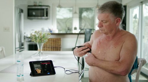 ESC Heart Failure Journal (@escheartfailure) on Twitter photo 🚨 Can patients self-detect signs of #HF worsening?
The HOUSE-HF study shows it's feasible and accurate with handheld ultrasound devices. A step toward home-based HF monitoring! 🫁📱
<a href="/PiotrPonikowski/">Piotr Ponikowski</a> <a href="/LeeGoldbergMD8/">Lee Goldberg</a> <a href="/JanBiegus/">Jan Biegus</a> #LUS #POCUS #echofirst #patient 🚨 Can patients self-detect signs of #HF worsening?
The HOUSE-HF study shows it's feasible and accurate with handheld ultrasound devices. A step toward home-based HF monitoring! 🫁📱
<a href="/PiotrPonikowski/">Piotr Ponikowski</a> <a href="/LeeGoldbergMD8/">Lee Goldberg</a> <a href="/JanBiegus/">Jan Biegus</a> #LUS #POCUS #echofirst #patient
