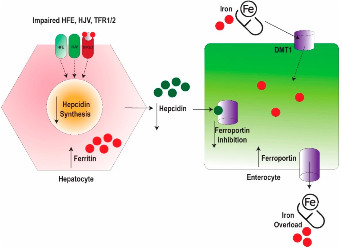 Hearts MDPI (@hearts_mdpi) on Twitter photo 🎊Happy to share the newly published #Review at <a href="/Hearts_MDPI/">Hearts MDPI</a> <a href="/MediPharma_MDPI/">MDPI Medicine & Pharmacology</a>
📚A Contemporary Review of Clinical Manifestations, Evaluation, and Management of Cardiac Complications of Iron Overload
✍️by <a href="/AnkitAgrawalMD/">Ankit Agrawal</a> <a href="/TomKMWang/">Tom Wang MBChB MD</a> et al.
Full text here👉 mdpi.com/2673-3846/6/3/… 🎊Happy to share the newly published #Review at <a href="/Hearts_MDPI/">Hearts MDPI</a> <a href="/MediPharma_MDPI/">MDPI Medicine & Pharmacology</a>
📚A Contemporary Review of Clinical Manifestations, Evaluation, and Management of Cardiac Complications of Iron Overload
✍️by <a href="/AnkitAgrawalMD/">Ankit Agrawal</a> <a href="/TomKMWang/">Tom Wang MBChB MD</a> et al.
Full text here👉 mdpi.com/2673-3846/6/3/…
