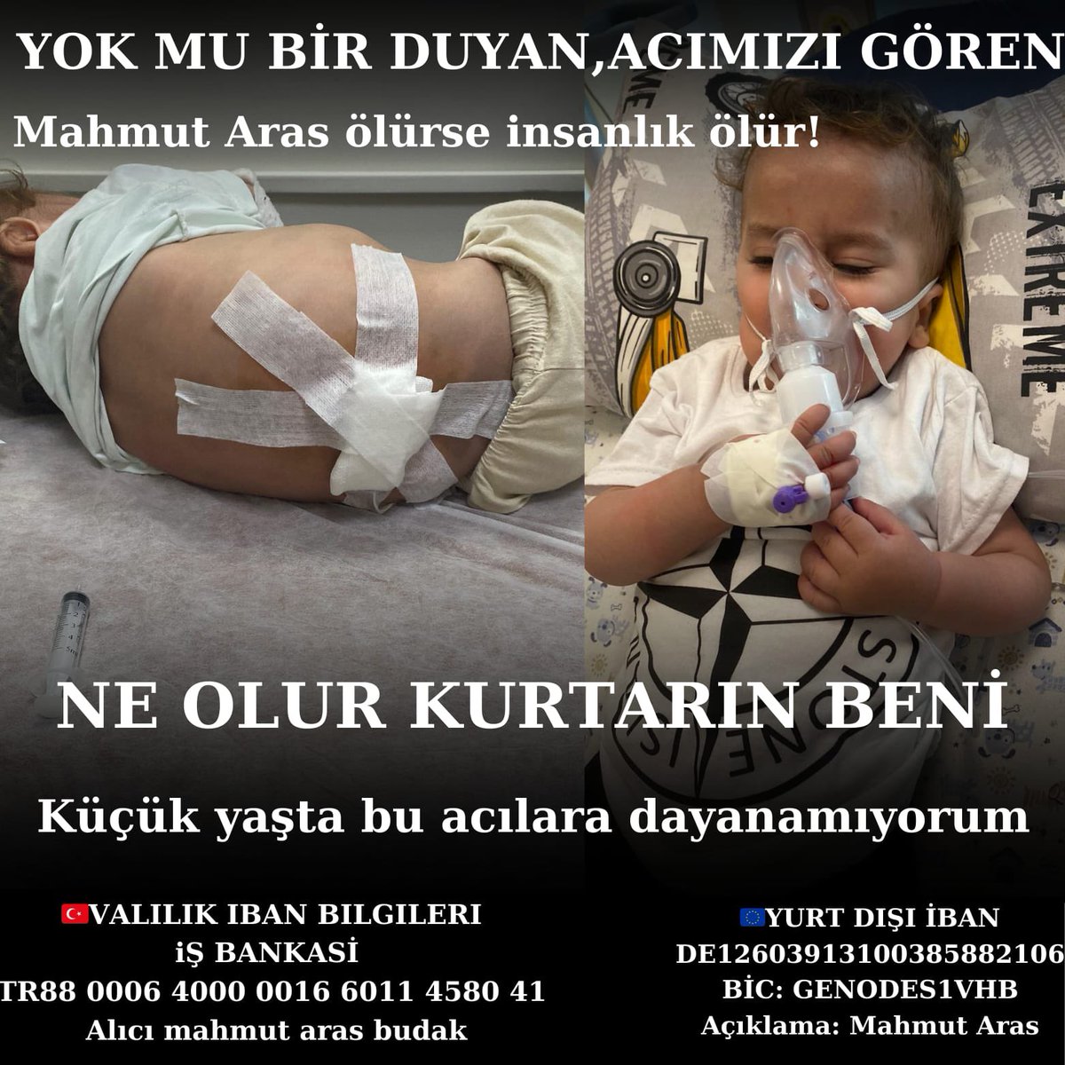 Bizim evladımızın kampanyası son %9 kaldı.

İki senedir uğraşıyoruz.

Çocuk uzun süredir hastanede yaşam mücadelesi veriyor. 

Geç kalmaktan çok korkuyoruz 

Ne olur takipcilerinize çağrı yapar mısınız?

Zamanında tedavi parası toplanmazsa çocuk ölecek.

Ne olur yardım edin. 😓