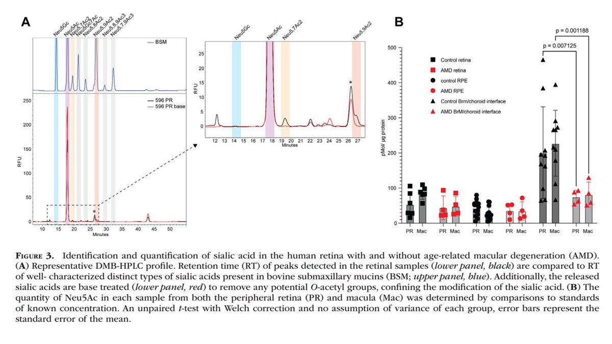 CzerwinsMarcin's tweet image. Another interesting paper form Pascal Gagneux. The sialome of human retina is altered in AMD, which may affect binding of complement factor F, and, consequently, alternative complement pathway regulation.
tinyurl.com/2fzw4wxk
#glycotime