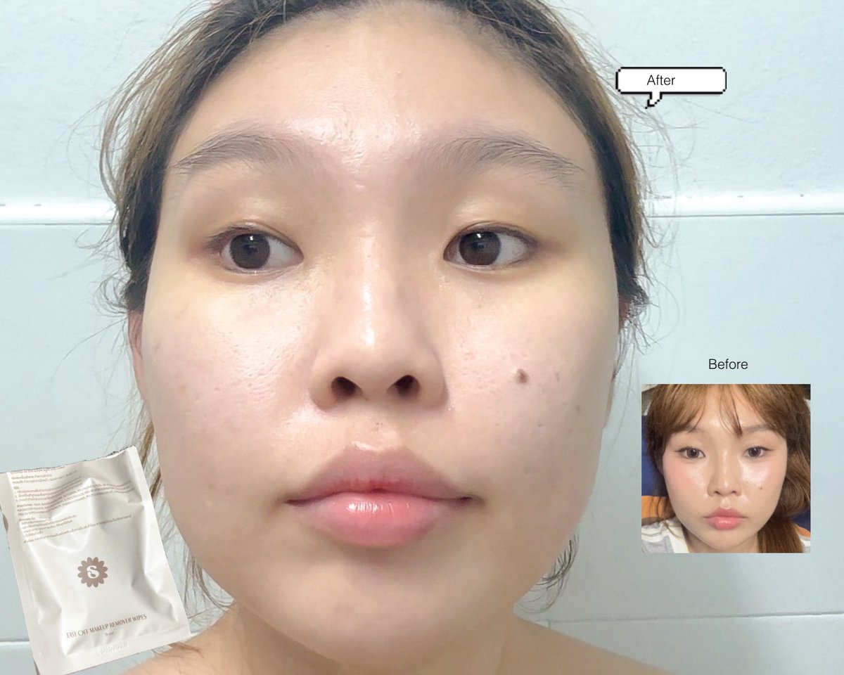 คนหน้าใหญ่แบบฉันคิดไว้ในหัวละว่าต้อง 2 แผ่นแน่เลย สรุปแผ่นเดียวเอาอยู่เฉย แล้วสะอาดจริงๆ เพราะลองเช็ดย้ำแล้วไม่มีคราบคสอ.เหลือเลย แพดนุ่มไม่เสียดหน้า ชุ่มชื้นพอดีไม่ฉ่ำเกิน ทำให้เช็ดตาไม่แสบ ไม่เจ็บผิว เช็ดได้นานจนเกลี้ยงคลีนซิ่งก็ยังเหลือไม่แห้งไวอะ ซองกักเก็บความชุ่มชื้นดี